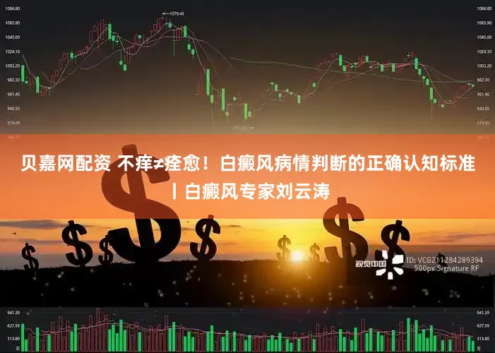 贝嘉网配资 不痒≠痊愈！白癜风病情判断的正确认知标准丨白癜风专家刘云涛